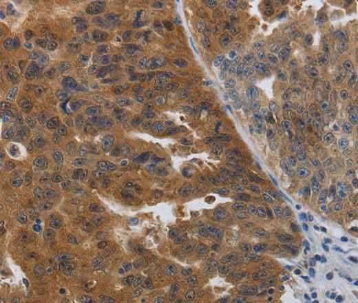 Anti-Human/Mouse/Rat PDCD2 Antibody