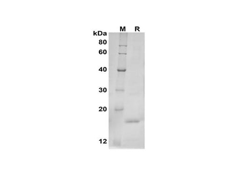 SDS-PAGE analysis of Mouse bFGF/FGF2 proteins, 2 μg/lane of Recombinant Mouse bFGF/FGF2 proteins was resolved with SDS-PAGE under reducing conditions, showing bands at 18 kDa.