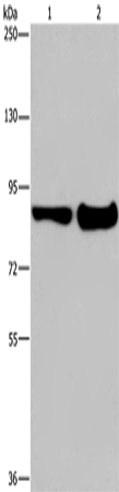 Anti-Human/Mouse ECE1 Antibody - ABMIUM
