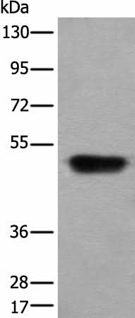 Western blot analysis of Human fetal liver tissue lysate using HNRNPH2 Polyclonal Antibody at dilution of 1:400