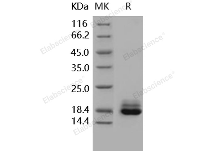Recombinant Human Cystatin C/CST3 Protein (His Tag) - ABMIUM