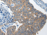 Anti-Human/Mouse RTN4IP1 Antibody - ABMIUM