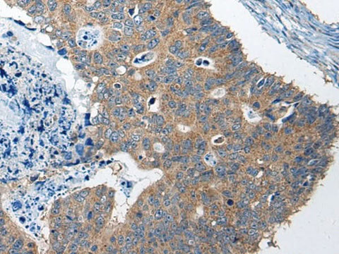 Anti-Human/Mouse RTN4IP1 Antibody - ABMIUM