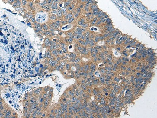 Anti-Human/Mouse RTN4IP1 Antibody - ABMIUM