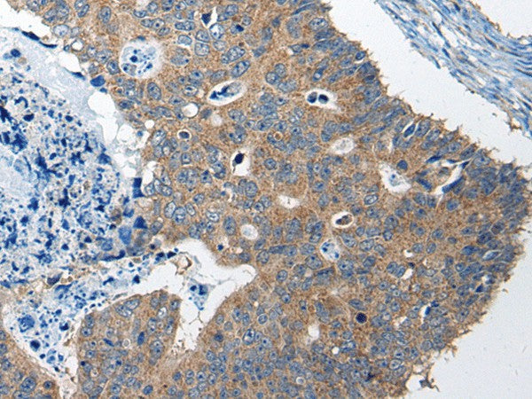 Anti-Human/Mouse RTN4IP1 Antibody - ABMIUM