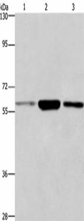 Anti-Human/Mouse GPC6 Antibody - ABMIUM
