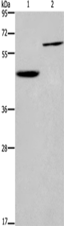 Anti-Human/Mouse/Rat DOK1 Antibody - ABMIUM