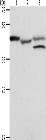 Anti-Human/Mouse PSMD6 Antibody - ABMIUM