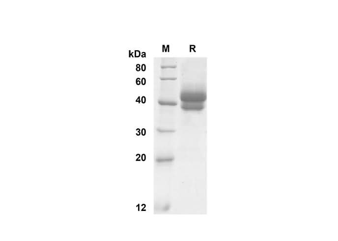 SDS-PAGE analysis of Mouse TSLP proteins , 2 μg/lane of Recombinant Mouse TSLP proteins was resolved with SDS-PAGE under reducing conditions , showing bands at 45 kDa.