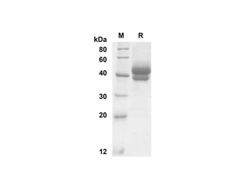 SDS-PAGE analysis of Mouse TSLP proteins , 2 μg/lane of Recombinant Mouse TSLP proteins was resolved with SDS-PAGE under reducing conditions , showing bands at 45 kDa.