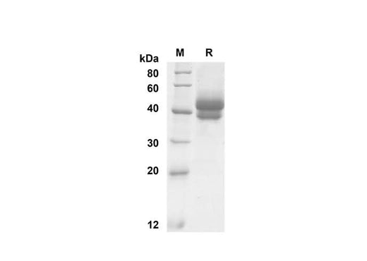 SDS-PAGE analysis of Mouse TSLP proteins , 2 μg/lane of Recombinant Mouse TSLP proteins was resolved with SDS-PAGE under reducing conditions , showing bands at 45 kDa.