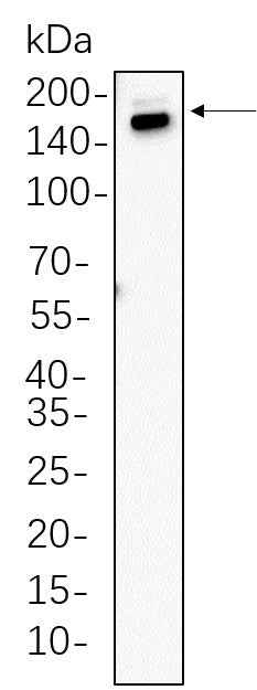 Anti-Human/Mouse/Rat Thrombospondin 1 Antibody [B618] - ABMIUM