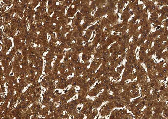 Anti-Human F10 Antibody [A1054] - ABMIUM