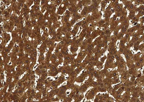 Anti-Human F10 Antibody [A1054] - ABMIUM