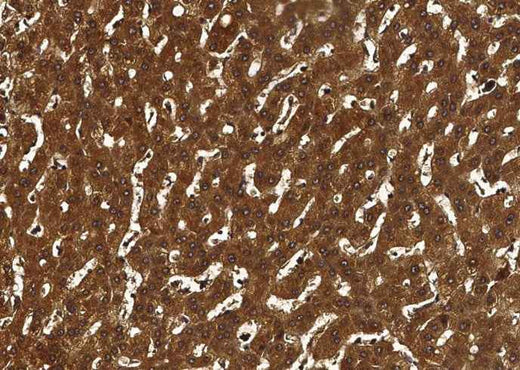 Anti-Human F10 Antibody [A1054] - ABMIUM
