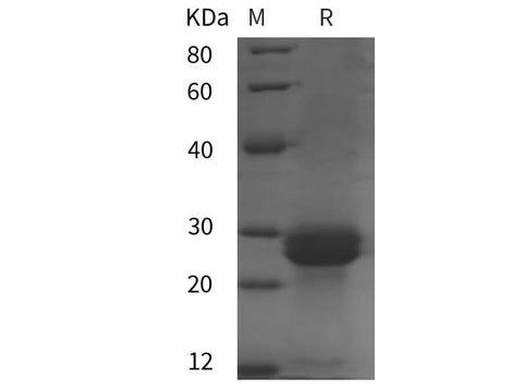 SDS-PAGE analysis of Mouse IL-33 proteins, 2 μg/lane of Recombinant Mouse IL-33 proteins was resolved with SDS-PAGE under reducing conditions, showing bands at 28 kDa.