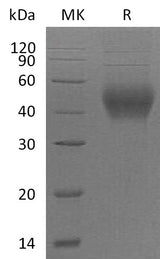 Recombinant Mouse CD48 Protein (His Tag) - ABMIUM
