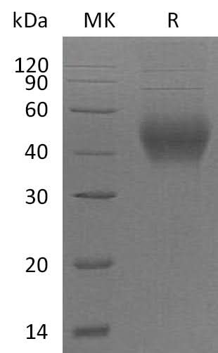 Recombinant Mouse CD48 Protein (His Tag) - ABMIUM