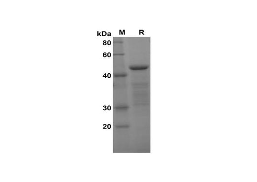 SDS-PAGE analysis of Human MMP-3 proteins, 2 μg/lane of Recombinant Human MMP-3 proteins was resolved with SDS-PAGE under reducing conditions, showing bands at 45 kDa.