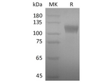 Recombinant SARS-CoV-2 S1 Protein - ABMIUM