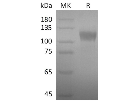 Recombinant SARS-CoV-2 S1 Protein - ABMIUM