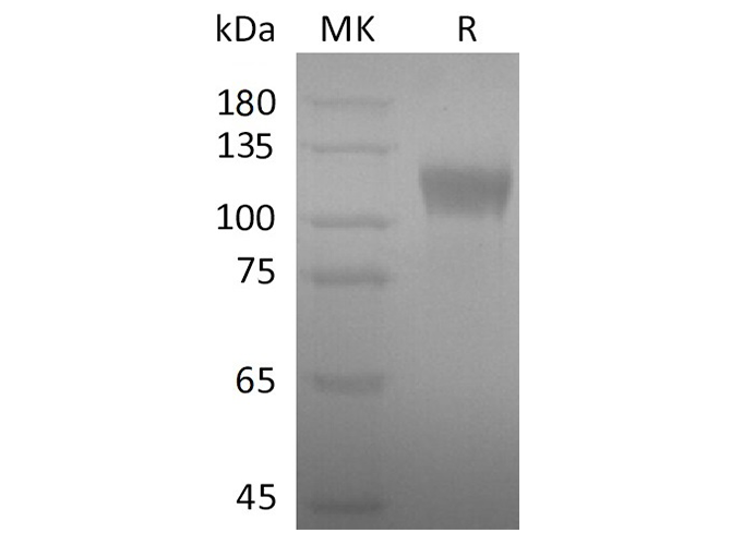 Recombinant SARS-CoV-2 S1 Protein - ABMIUM