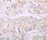 Anti-Human ADCY7 Antibody - ABMIUM