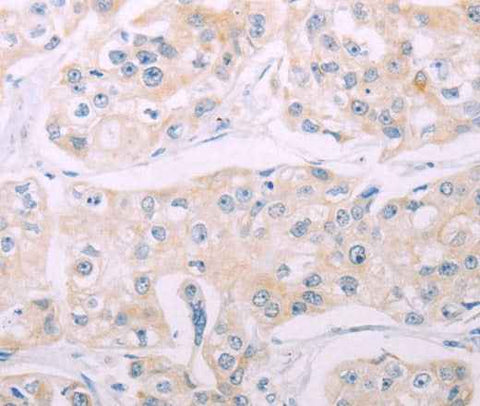 Anti-Human ADCY7 Antibody