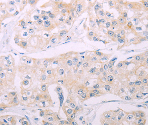 Anti-Human ADCY7 Antibody - ABMIUM