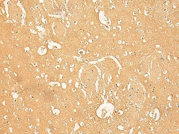 Immunohistochemistry of paraffin-embedded Human brain tissue using RNASE4 Polyclonal Antibody at dilution of 1:45(×200)