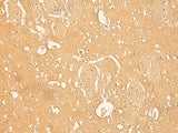 Immunohistochemistry of paraffin-embedded Human brain tissue using RNASE4 Polyclonal Antibody at dilution of 1:45(×200)