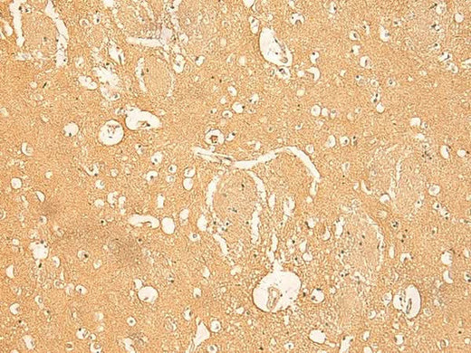 Immunohistochemistry of paraffin-embedded Human brain tissue using RNASE4 Polyclonal Antibody at dilution of 1:45(×200)