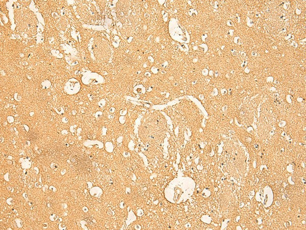Immunohistochemistry of paraffin-embedded Human brain tissue using RNASE4 Polyclonal Antibody at dilution of 1:45(×200)