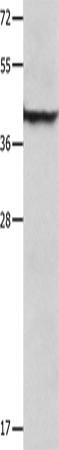 Anti-Human/Mouse SERPINB5 Antibody - ABMIUM