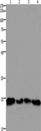 Anti-Human/Mouse HMGB3 Antibody - ABMIUM