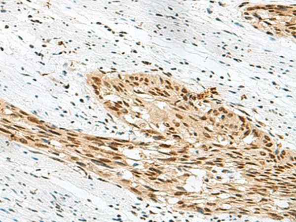 Anti-Human/Mouse RBM12 Antibody