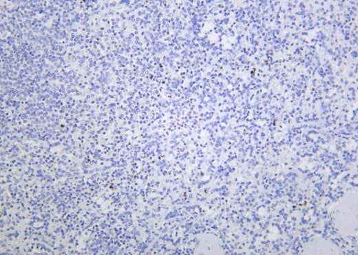 Anti-Human/Mouse/Rat Histone H4 Antibody [B1162] - ABMIUM