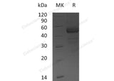 Recombinant Human TDGF1 Protein (Fc Tag) - ABMIUM