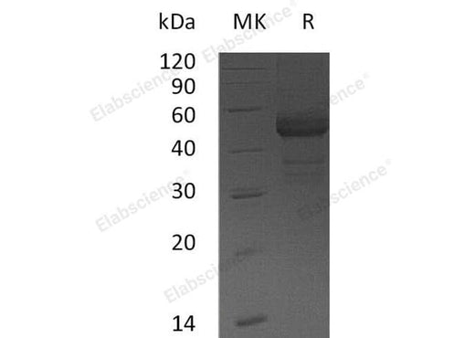 Recombinant Human TDGF1 Protein (Fc Tag) - ABMIUM