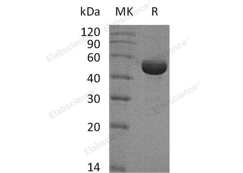 Recombinant Human SHMT1 Protein (His Tag) - ABMIUM