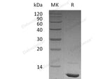 Recombinant Human IGF-1/IGF1 Protein(His Tag) - ABMIUM