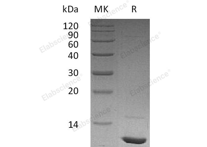 Recombinant Human IGF-1/IGF1 Protein(His Tag) - ABMIUM
