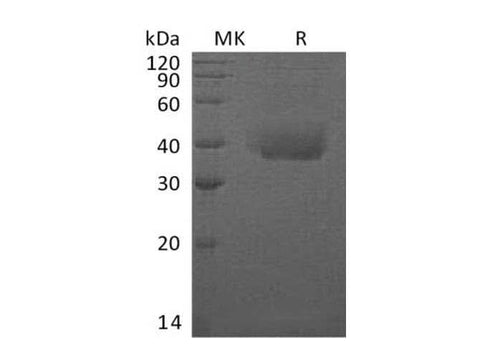 Recombinant Human TEM8/ATR Protein (His Tag) - ABMIUM