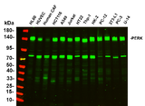 Anti-Human/Mouse/Rat PERK Antibody [B756]