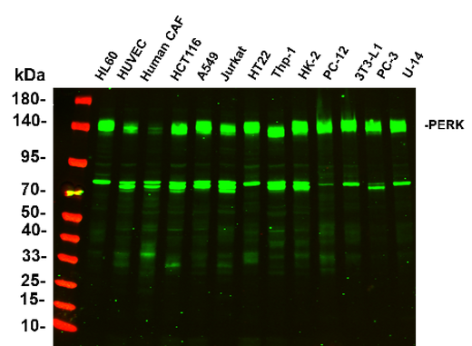 Anti-Human/Mouse/Rat PERK Antibody [B756] - ABMIUM
