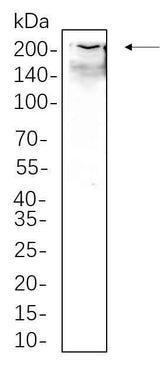 Anti-Human/Mouse/Rat Collagen I Antibody [B1074]