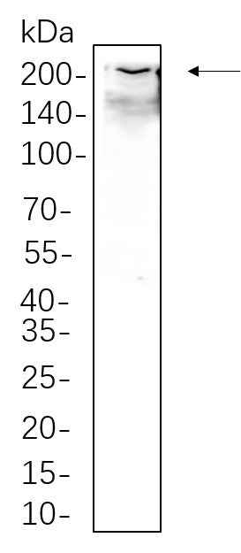 Anti-Human/Mouse/Rat Collagen I Antibody [B1074]
