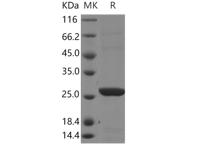 Recombinant Human Glutathione S-transferase theta-2B/GSTT2B Protein (His Tag) - ABMIUM