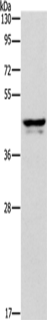 Anti-Human APOL1 Antibody - ABMIUM