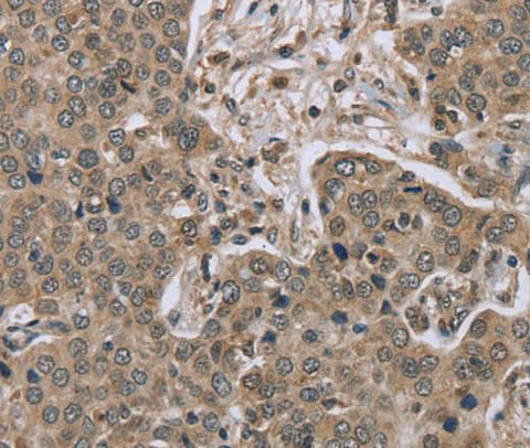 Anti-Human/Mouse IL15RA Antibody - ABMIUM